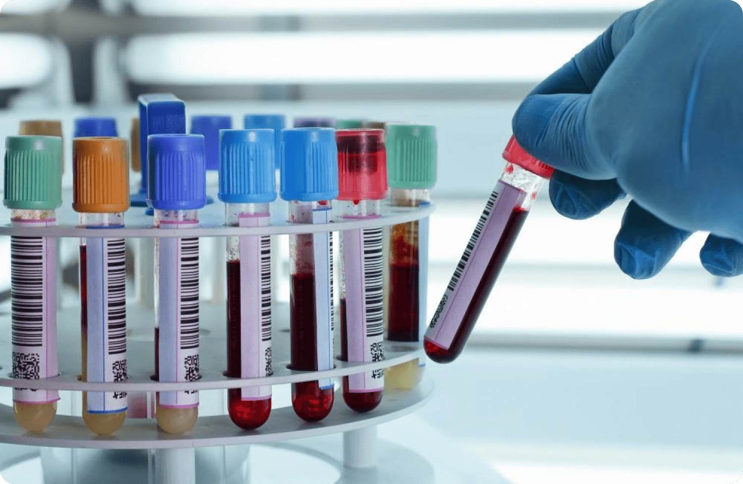 Qualität in der Labormedizin sichern dank Präanalytik bei Blutentnahmen