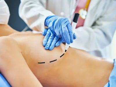 Brustvergrößerung mit Eigenfett: So unterstützen Sie den Heilungsprozess