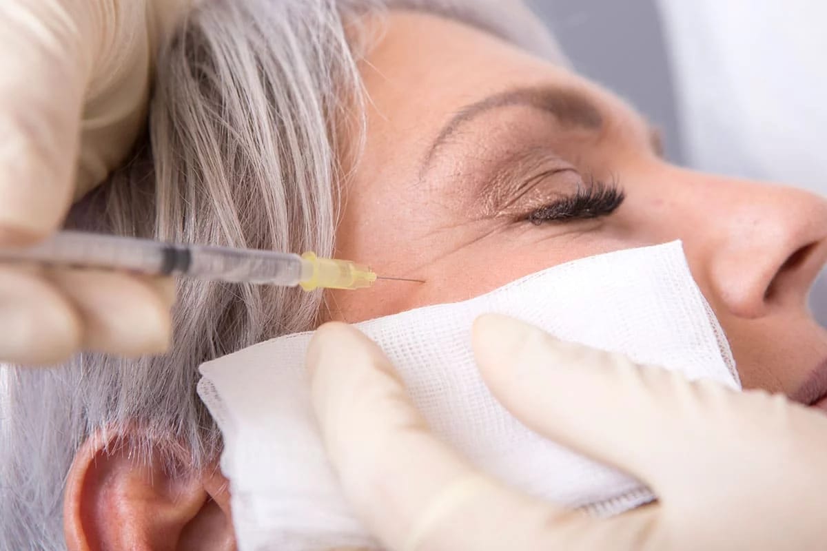 Botox Nürnberg: Behandlungsablauf und mögliche Nebenwirkungen